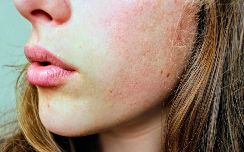 Peau brillante et rosacea : équilibre et sérénité 50+